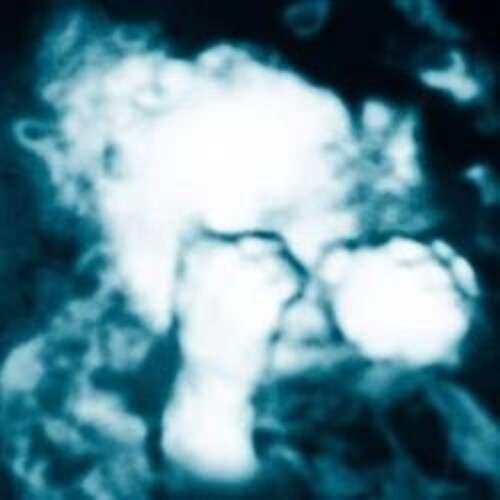 Sandra Monfort- Nino Reptil Angel ( LP )